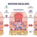 wound healing process