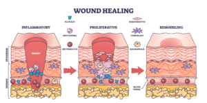 wound healing process