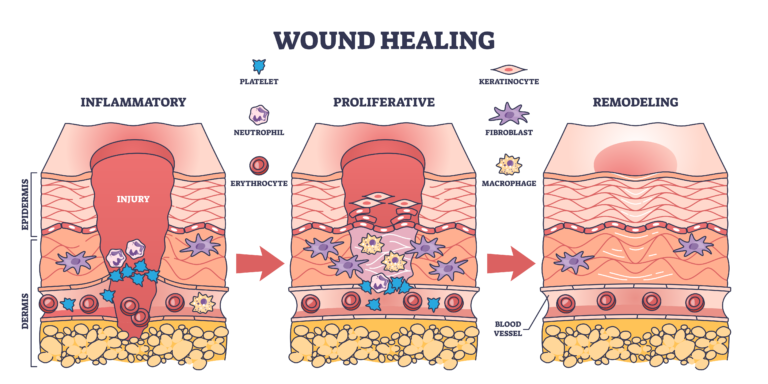 wound healing process