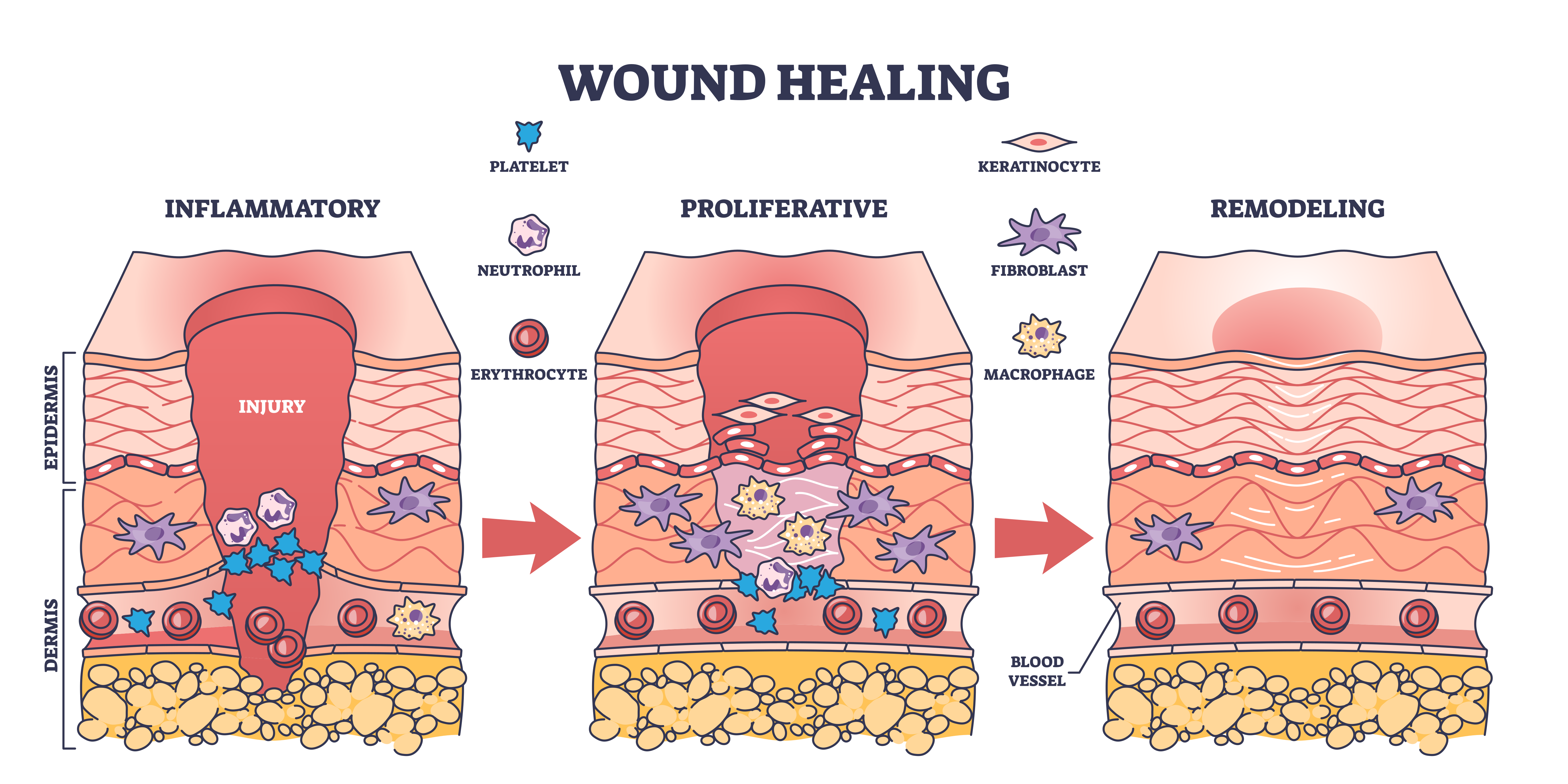 wound healing process