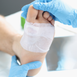 Diabetic Foot Wounds