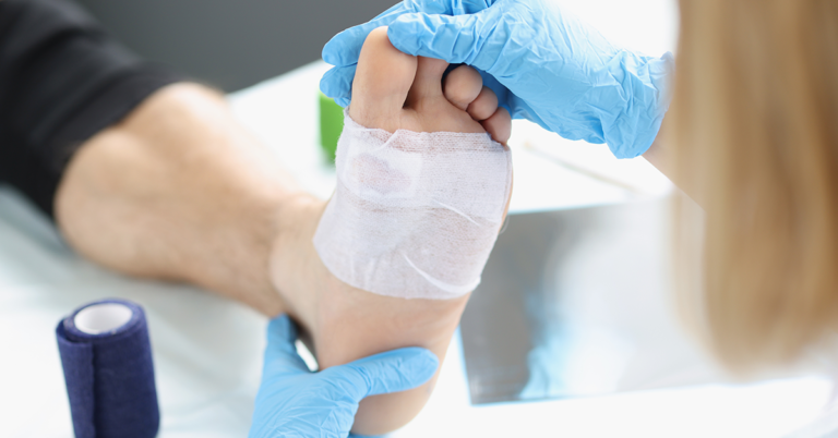 Diabetic Foot Wounds