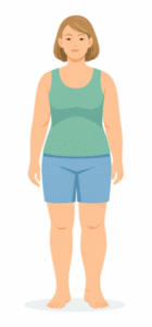 Lymphedema swollen leg